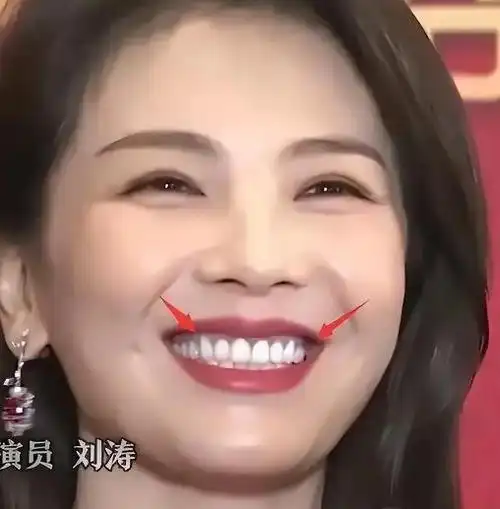 明星"烤瓷牙"有多吸睛?"嘴凸显老,牙比灯还亮",看看都有谁