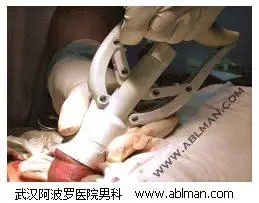 老年人包茎包皮环切手术过程直播(图)