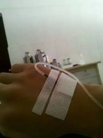 打吊针图片真实图片但每个人的又有所不同但结构