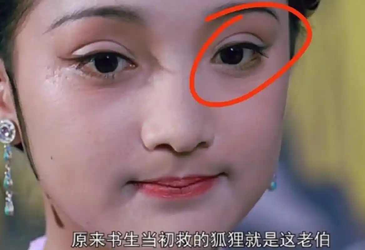 周迅大明宫词里边就开始贴双眼皮了嘛!