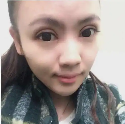 年轻时割双眼皮老了后会变成啥样子网友吓得捂住了双眼