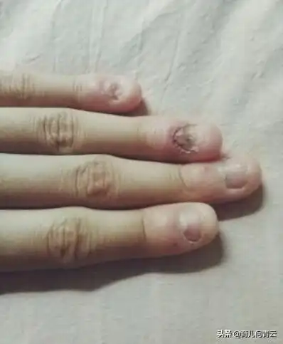 孩子总咬指甲真正的原因在这里