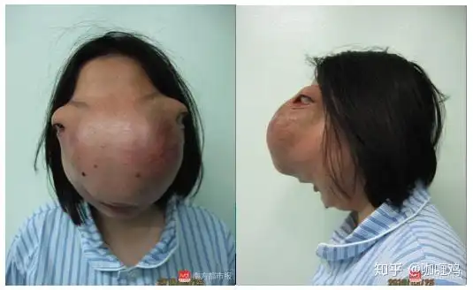 整容的极限是什么?