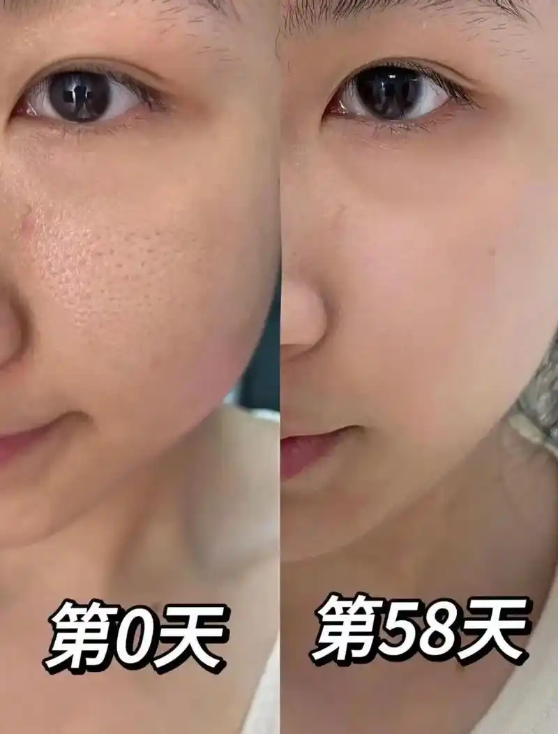 改善毛孔技巧98毛孔粗大姐妹必看巨有效73.