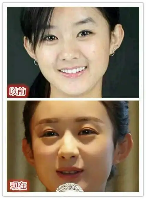 赵丽颖被化妆师坑双眼皮贴就这么放出来了