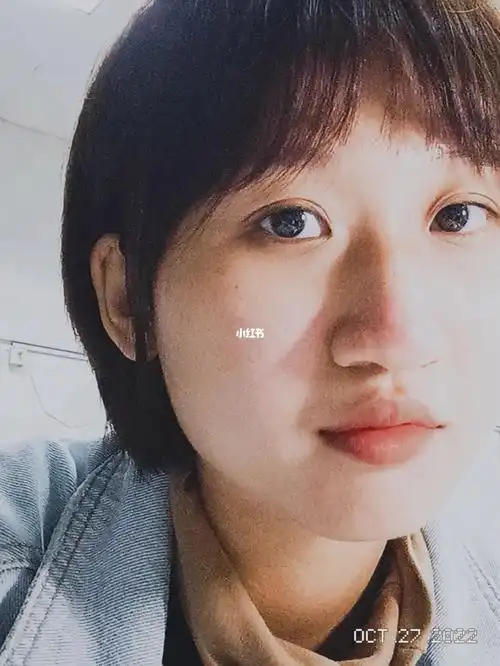 短发实在太适合我了937215菱形脸头发遮盖太阳穴凹陷位置72