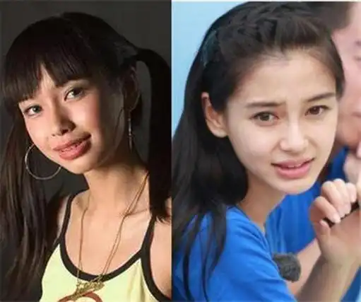 baby整容前后照片,angelababy整容前后