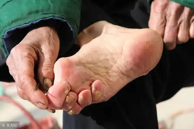 触目惊心的过往三寸金莲的畸形美