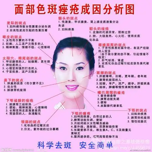 详细划分的话,出现的地方不同就有不同的原因