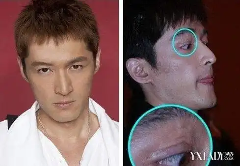 【图】胡歌毁容前后对比照片 从何炅手上抢走了李逍遥的角色
