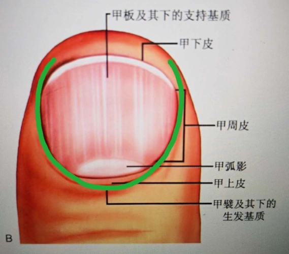 通常是甲根部肉刺,甲咬伤,刺伤以及指(趾)甲过度修剪导致的,多数病原