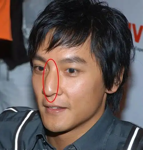 鼻梁的上端有凸起,形似驼峰或结节状,鼻尖有点下勾,按理说并不符合