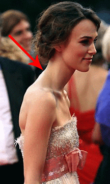 脖子前倾,也叫探颈,猥琐颈.