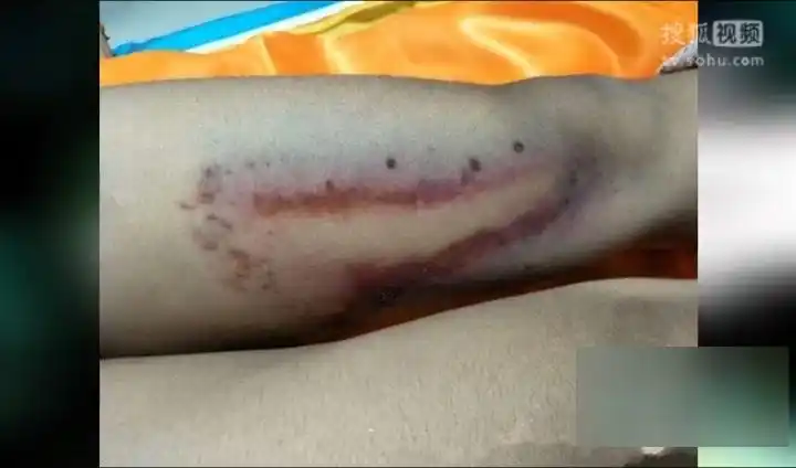 济南一女大学生校内裸体坠亡尸体满是伤痕淤青