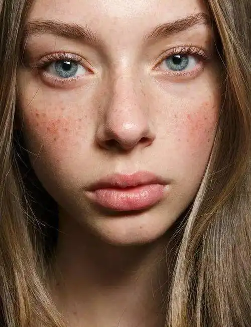 你的肌肤敏感了吗