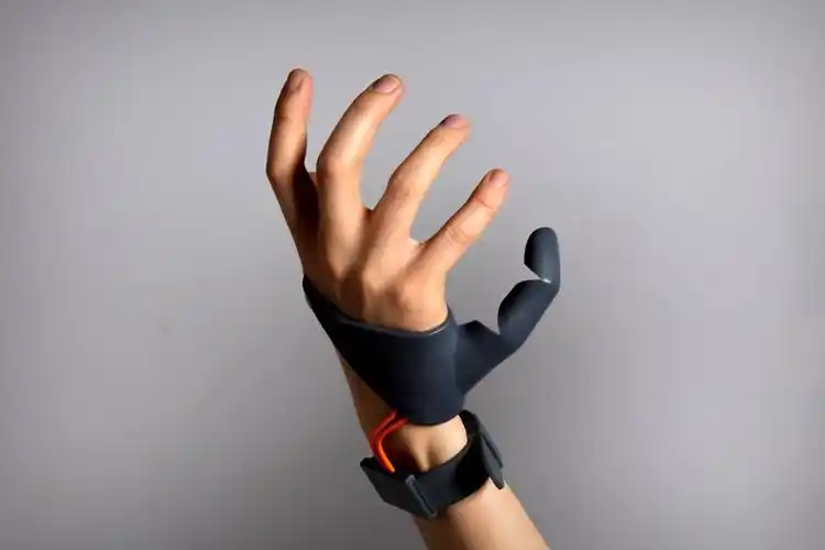 你的第六根手指居然长这样可3d打印的智能假肢