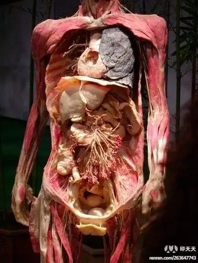 北京尸展,除了眼球,都是真的