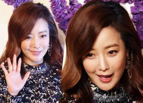 整容后遗症太吓人韩国第一美女金喜善如今40岁变成这样
