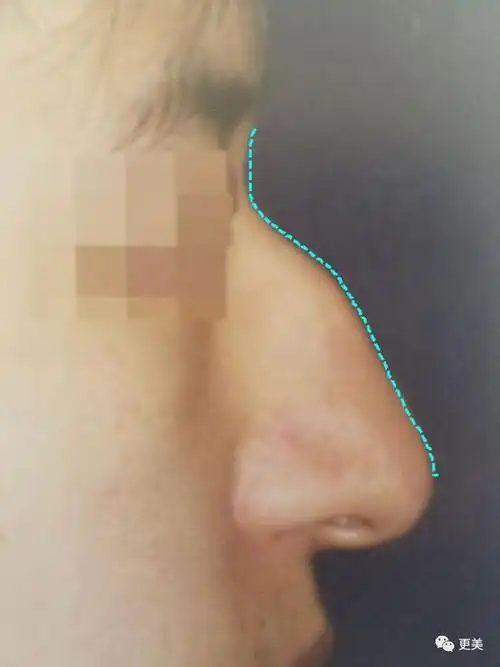 三字女星被劈腿后走出阴影重回颜巅,公开回应是炒作还是真性情