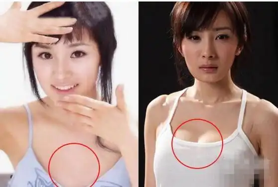 为什么观众都说杨幂整形呢