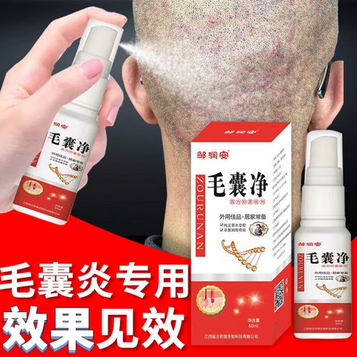 头痒真菌头皮屑多毛囊炎头部专用非药喷雾剂头部严重头屑头痒有疙瘩