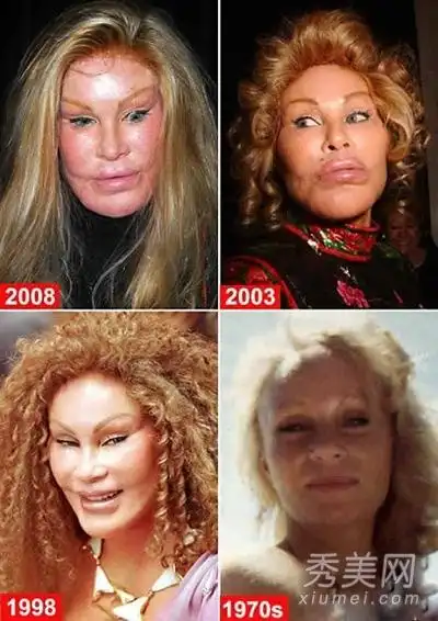 曝光整容失败的女星 世界排行榜前10你看多恐怖_新浪四川时尚_新浪