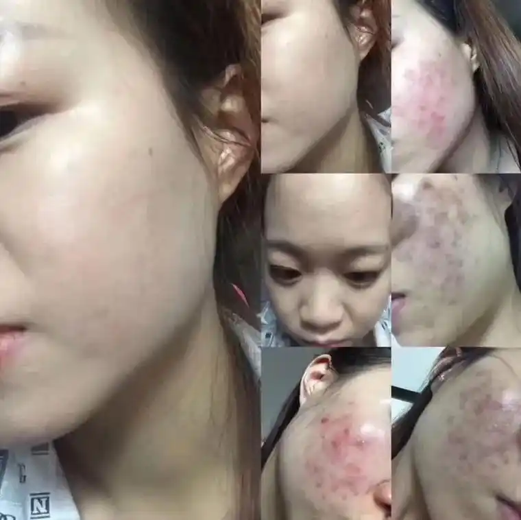 可以不整形,但一定要调肤 万年流行的永远只有好皮肤[机智]  - 抖音