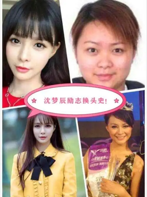 干货分享沈梦辰的整容史,真堪称励志