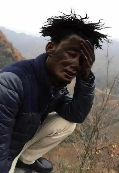 世界上十大最倒霉的人被雷劈