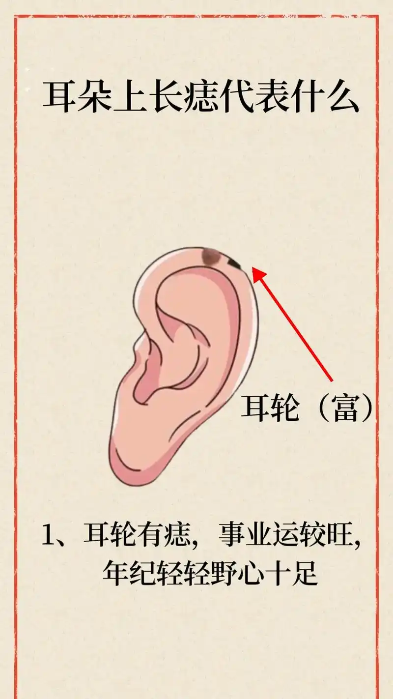 耳朵旁边痣相图解大全#面部风水 - 抖音
