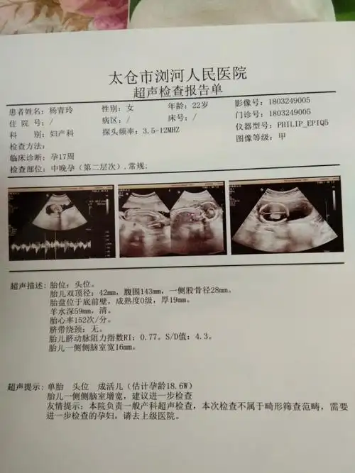 怀孕4个月了,检查胎儿一侧侧脑室宽16mm怎么办?