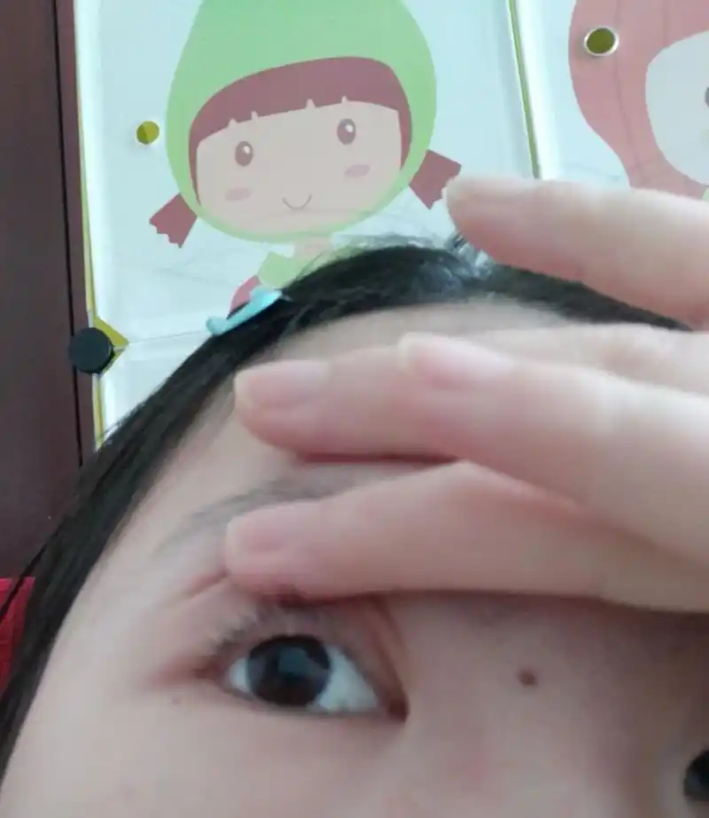 上眼睑的这个白色小点点是什么呀?