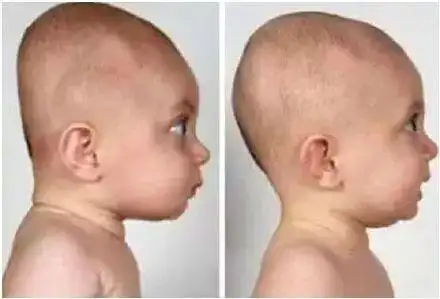 扁头和圆头有什么不同?刘昊然和雷佳音头围相同,视觉差异却很大