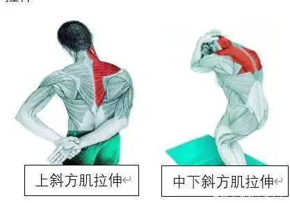 斜方肌拉伸方法