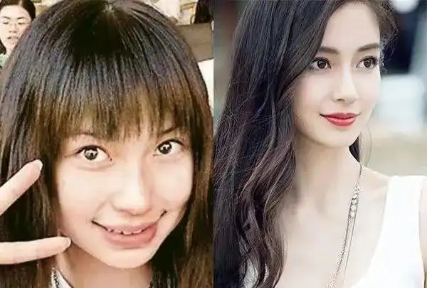 初见貌美如花再见脸残吓人的6大女星都被整容害惨了