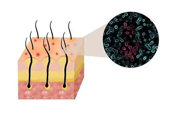 为什么头皮瘙痒,有头屑?