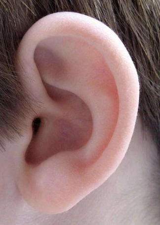 招风耳矫正 (39)