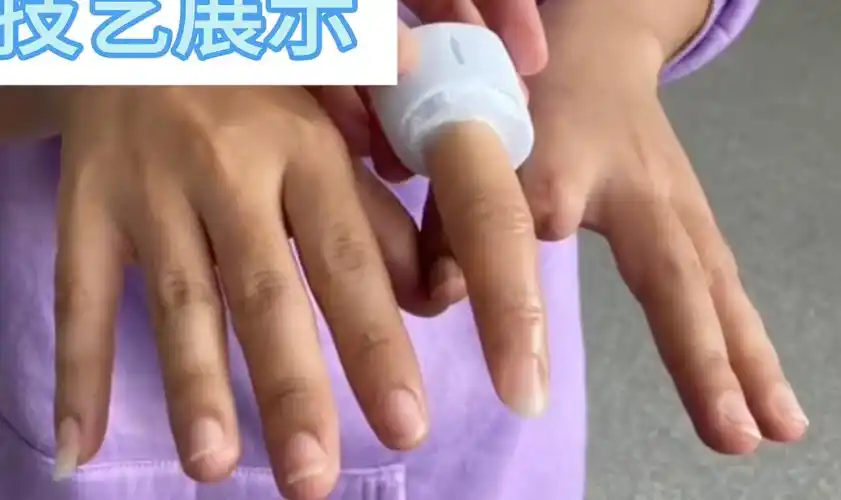手工做一个手指假肢,这样的硅胶假手指虽然是假的,不过都是仿真的,把