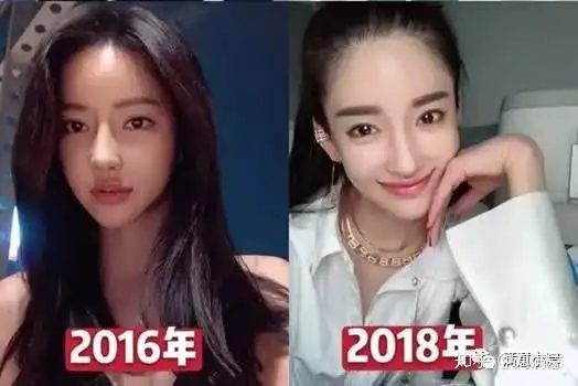 潘南奎的整容史,整容前照片大公开另外,网上有关于潘南奎的详细资料和