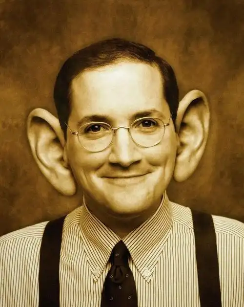 【招风耳-不该露头的露了头】耳朵是最不受人待见的五_圈子-新氧美容