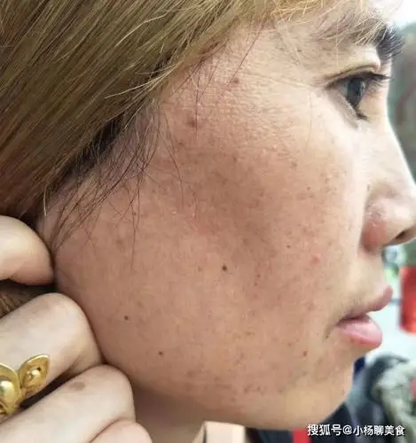 女性脸部皮肤粗糙平时应多吃这4种嫩肤菜保护皮肤防干燥