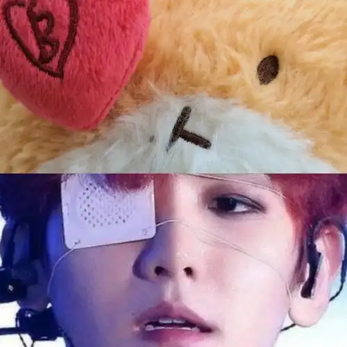 坨坨麦粒肿了00