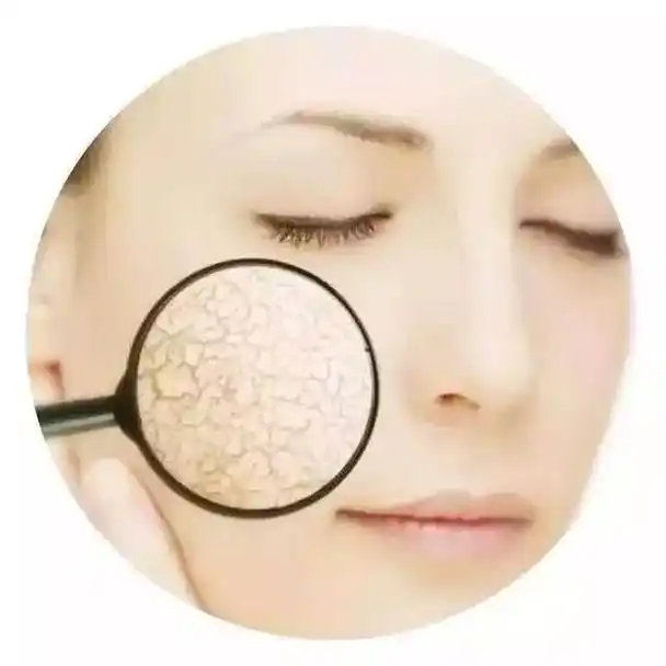 如何精确地辨别自己的皮肤类型及护肤方法