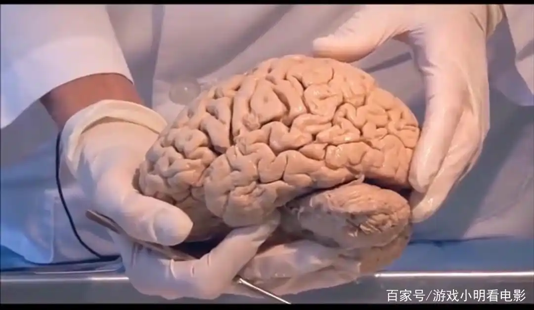 爱因斯坦死后的大脑被偷走后,被切成240块做研究