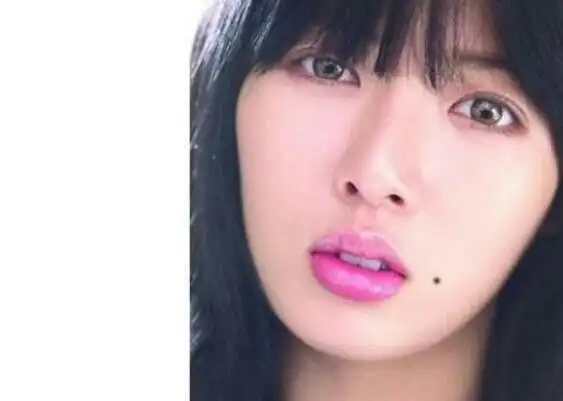 嘴角有痣