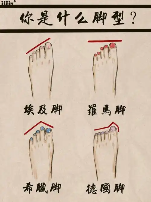 干货四种经典脚型如何选鞋建议收藏
