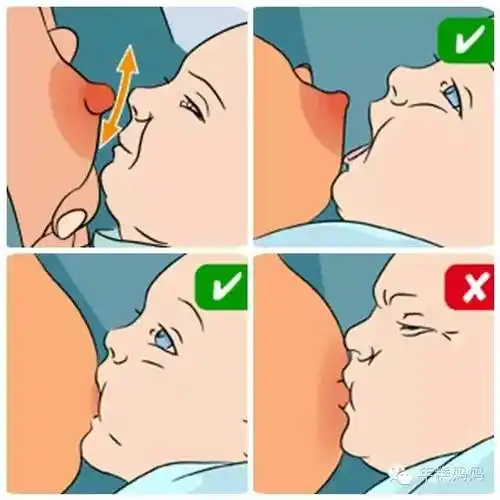 此外要养成正确的哺乳姿势,哺乳时母亲要将奶头和大部分乳晕送入婴儿
