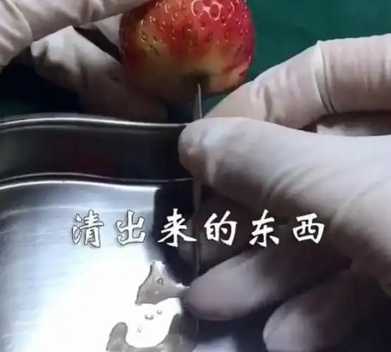 如何堕胎(一个月可以打掉吗)「干货分享」-生活小妙招网