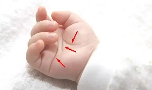 耳朵有这个特征的孩子,聪明过人可能是神童,会是你家的宝宝?