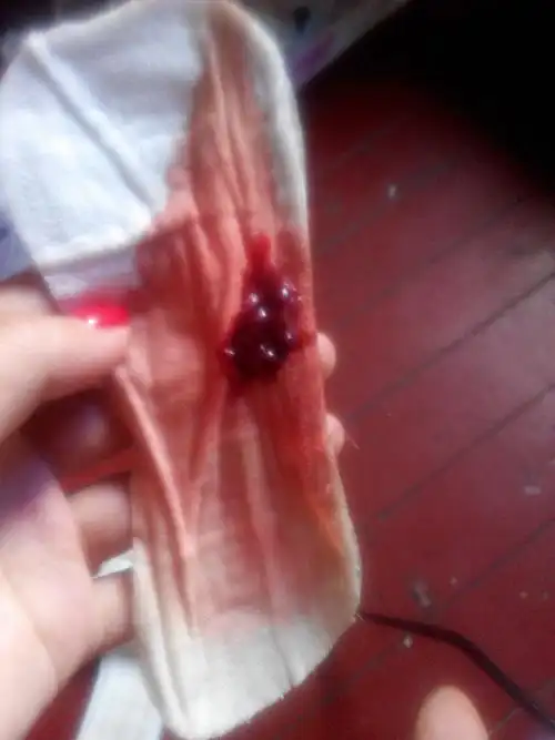 我应该21号来月经昨天12号用今天早上尿尿完事擦